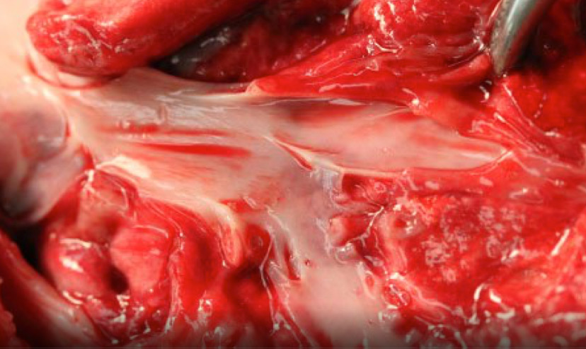 Heart showing vascular damage